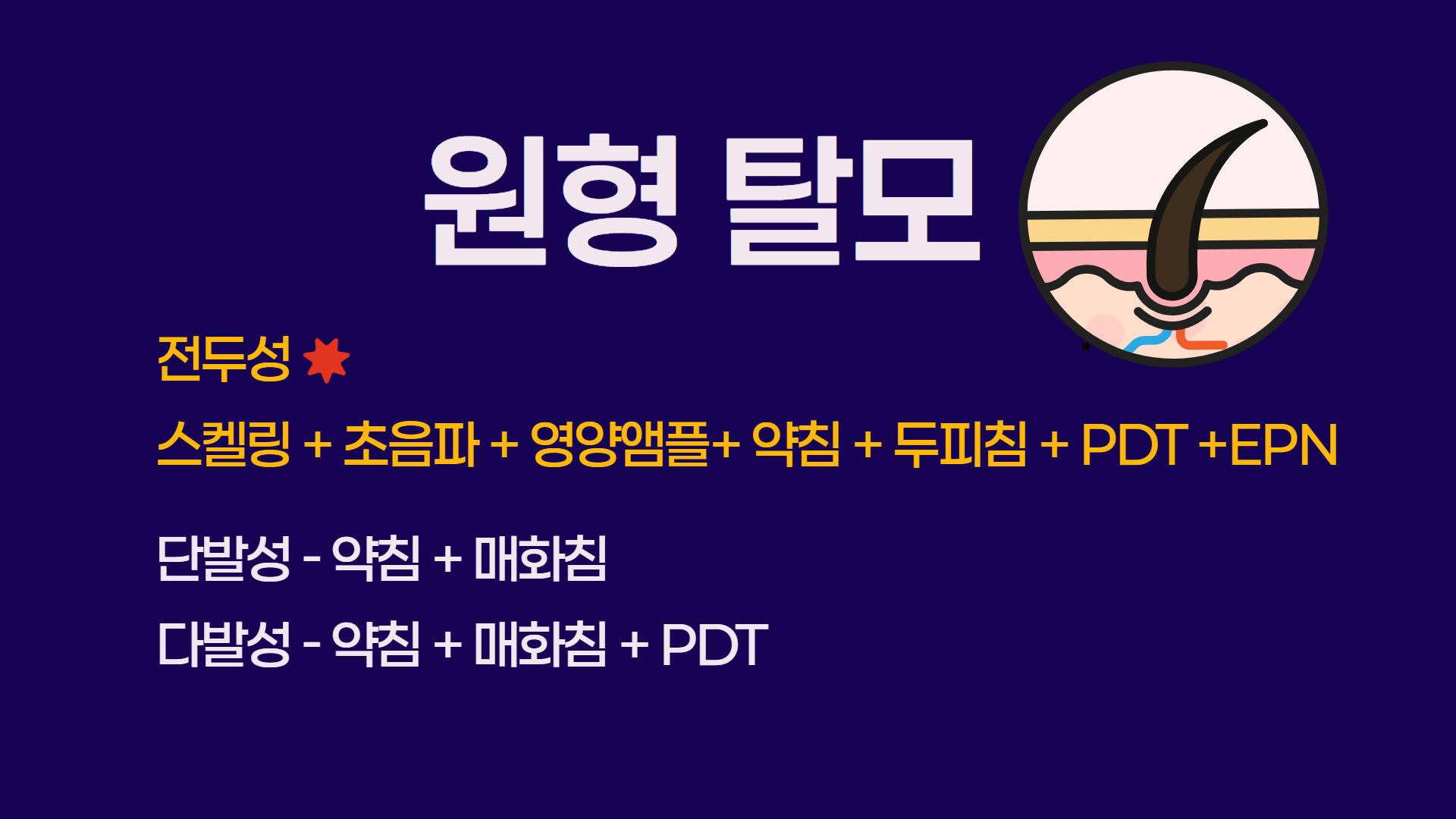 원형탈모 진료 프로그램 안내